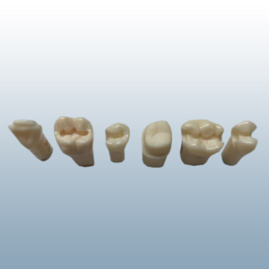 Kilgore Replacement Teeth - Cavity Prep